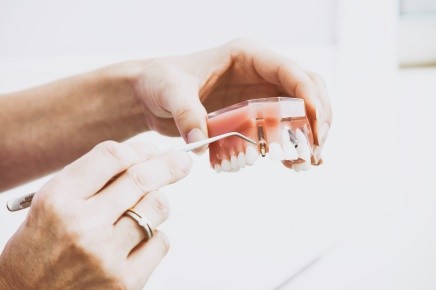 Hvordan implantater sidder fast i gummerne.